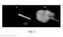 Fig. 02 - Targeted structure-specific particulate delivery systems