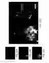 Fig. 22 - Targeted structure-specific particulate delivery systems