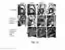 Fig. 22 - COLLAGEN IMAGING COMPOSTIONS