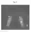 Fig. 04 - Method for imaging arthritis
