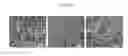 Fig. 11 - Collagen compositions and methods of use