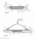 Fig. 03 - Reduced pressure treatment system