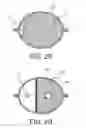 Fig. 04 - Fluid container for a hemodialysis system