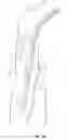 Fig. 14 - Methods and devices for percutaneous implantation of arterio-venous grafts