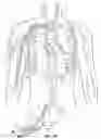 Fig. 15 - Methods and devices for percutaneous implantation of arterio-venous grafts
