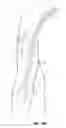 Fig. 18 - Methods and devices for percutaneous implantation of arterio-venous grafts
