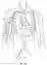 Fig. 23 - Methods and devices for percutaneous implantation of arterio-venous grafts