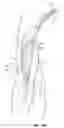 Fig. 24 - Methods and devices for percutaneous implantation of arterio-venous grafts