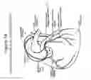 Fig. 04 - Adjustable medium diverter