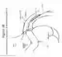 Fig. 05 - Adjustable medium diverter