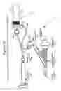 Fig. 15 - Adjustable medium diverter