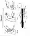 Fig. 35 - Adjustable medium diverter