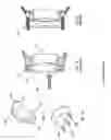 Fig. 03 - Sound mitigation structures and methods for use in treating obstructive sleep apnea