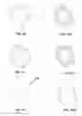 Fig. 09 - Sound mitigation structures and methods for use in treating obstructive sleep apnea