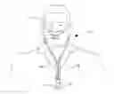 Fig. 01 - VENTILATION INTERFACE FOR SLEEP APNEA THERAPY