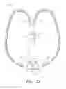 Fig. 03 - VENTILATION INTERFACE FOR SLEEP APNEA THERAPY