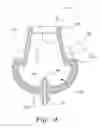 Fig. 06 - VENTILATION INTERFACE FOR SLEEP APNEA THERAPY