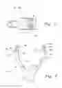 Fig. 07 - VENTILATION INTERFACE FOR SLEEP APNEA THERAPY