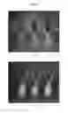 Fig. 07 - Method of manufacturing microneedle and microneedle manufactured thereby
