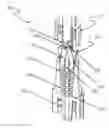 Fig. 01 - Sterile connection luer access device