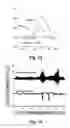 Fig. 19 - ACCESSING SPINAL NETWORK TO ENABLE RESPIRATORY FUNCTION