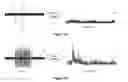 Fig. 04 - System and method of pain relief based on frequency based analysis of temporal nociceptive signals