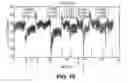 Fig. 13 - Methods and systems for controlling blood pressure by controlling atrial pressure