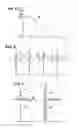 Fig. 04 - System and methods for capture verification in implantable leadless pacemakers