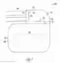 Fig. 02 - Chip or silicon based feedthrough