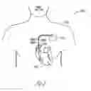 Fig. 07 - Chip or silicon based feedthrough