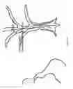 Fig. 83 - Head-worn therapy device