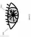 Fig. 87 - Head-worn therapy device