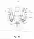 Fig. 09 - Arm extension exercise apparatus