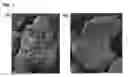 Fig. 02 - Super absorbent polymer