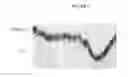 Fig. 09 - In vitro epithelial models comprising lamina propria-derived cells