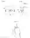 Fig. 02 - Foreign matter removal device and vehicle provided with same