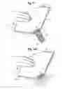 Fig. 09 - Process for in situ production of microcapillary dispensing system for flexible pouch