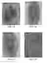 Fig. 02 - Antibodies targeting B-cell receptor complex membrane bound IgM and uses thereof