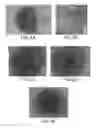 Fig. 03 - Antibodies targeting B-cell receptor complex membrane bound IgM and uses thereof