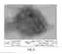 Fig. 04 - Antibodies targeting B-cell receptor complex membrane bound IgM and uses thereof