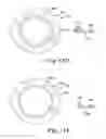 Fig. 16 - Process of Producing Aggregates of Cleaned Coal Fines and Beneficiated Organic-Carbon-Containing Feedstock