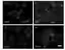 Fig. 01 - Methods for treating a brain tissue damage by cultured adult pluripotent olfactory stem cells
