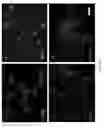 Fig. 02 - Methods for treating a brain tissue damage by cultured adult pluripotent olfactory stem cells