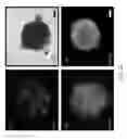 Fig. 08 - Methods for treating a brain tissue damage by cultured adult pluripotent olfactory stem cells