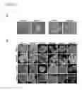 Fig. 12 - DIFFERENTIATING INDUCED PLURIPOTENT STEM CELLS INTO GLUCOSE-RESPONSIVE, INSULIN-SECRETING PROGENY