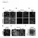 Fig. 23 - DIFFERENTIATING INDUCED PLURIPOTENT STEM CELLS INTO GLUCOSE-RESPONSIVE, INSULIN-SECRETING PROGENY