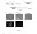 Fig. 03 - VASCULARIZED TISSUE, SKIN OR MUCOSA EQUIVALENT
