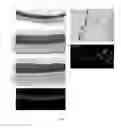 Fig. 06 - VASCULARIZED TISSUE, SKIN OR MUCOSA EQUIVALENT