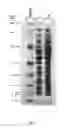 Fig. 02 - Polycistronic expression system for bacteria