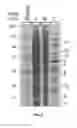Fig. 08 - Polycistronic expression system for bacteria